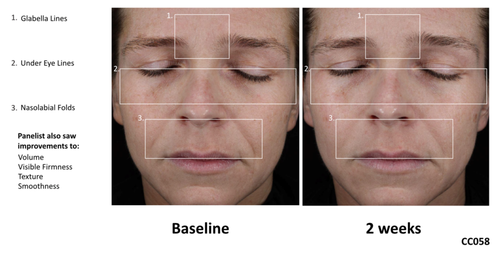 Volpura EPO
diminished facial wrinkles