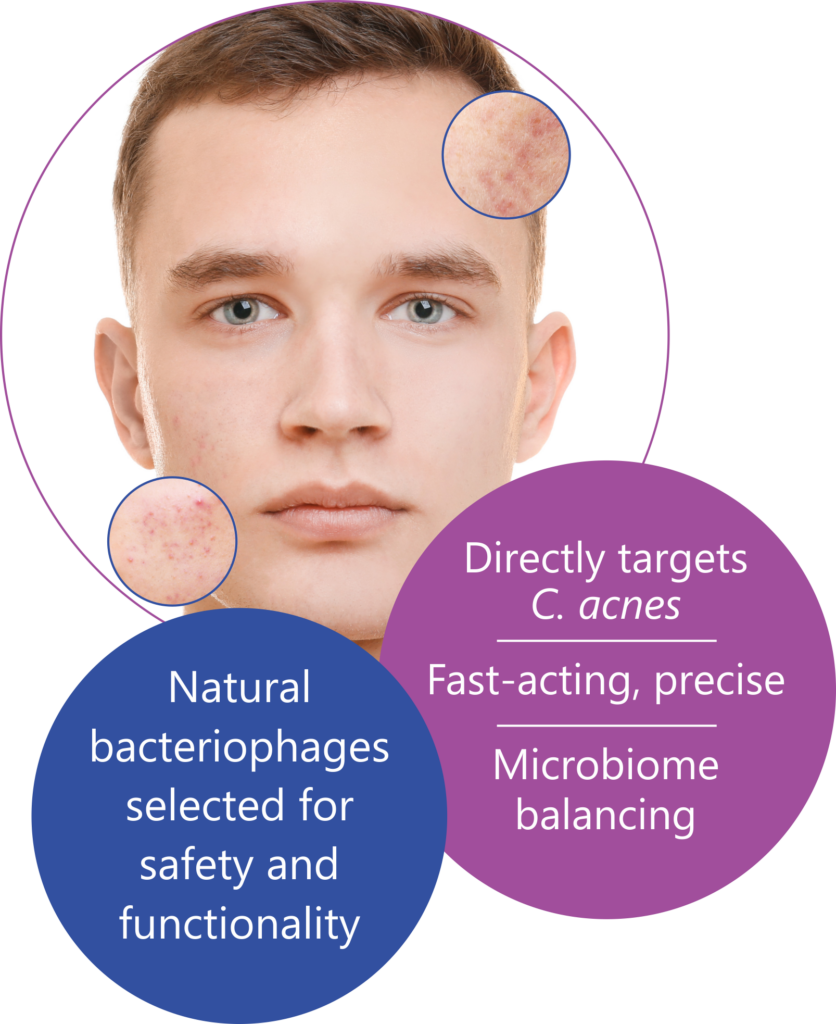Dermaphage CA HH bubbles
