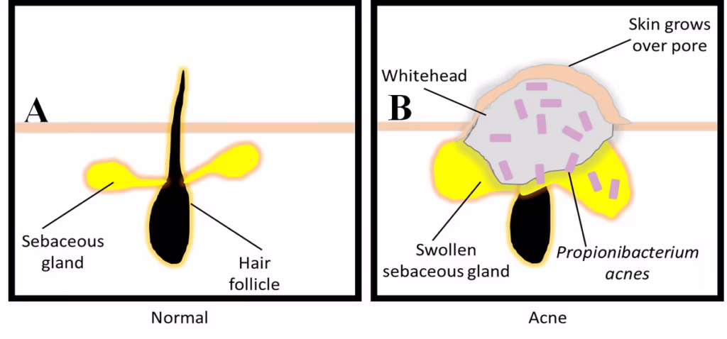 bacteriophage figure 1